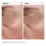 Niacinamide 5% Face and Body Emulsion - Image 3